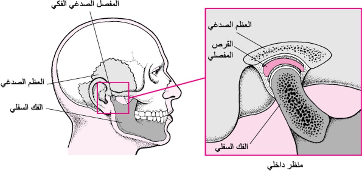 المفصل الفكي الصدغي