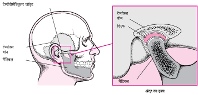 टेम्पोरोमैंडिबुलर जॉइंट
