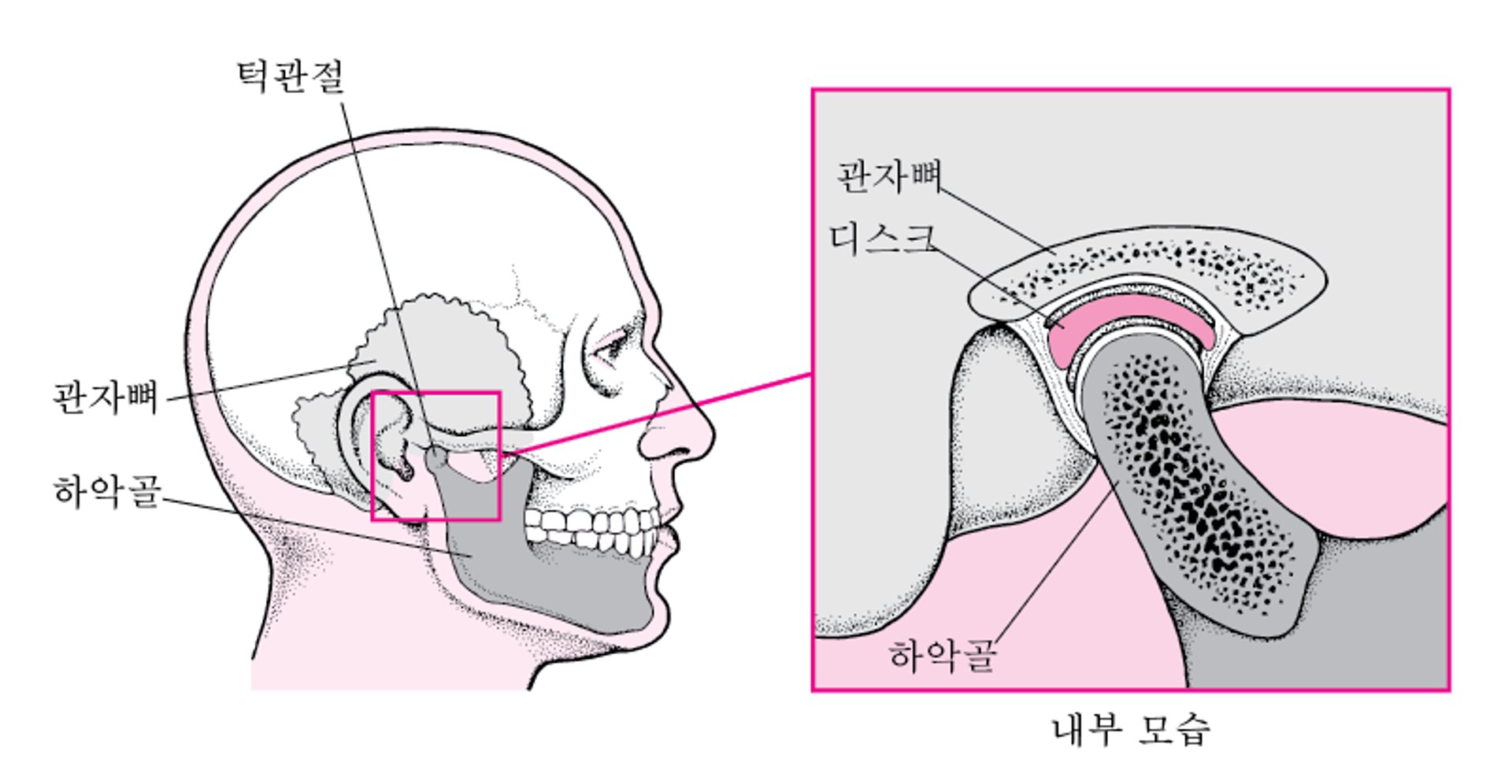 측두하악 관절