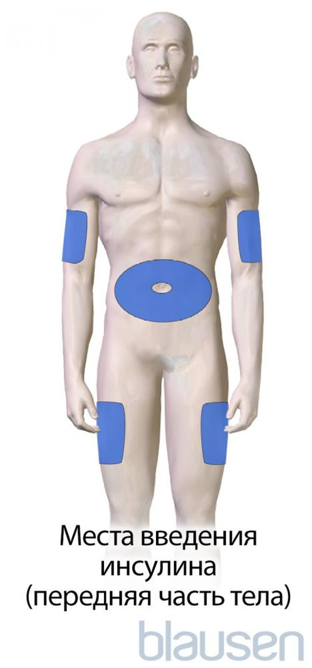 Диабет Места введения инсулина (передняя часть тела)