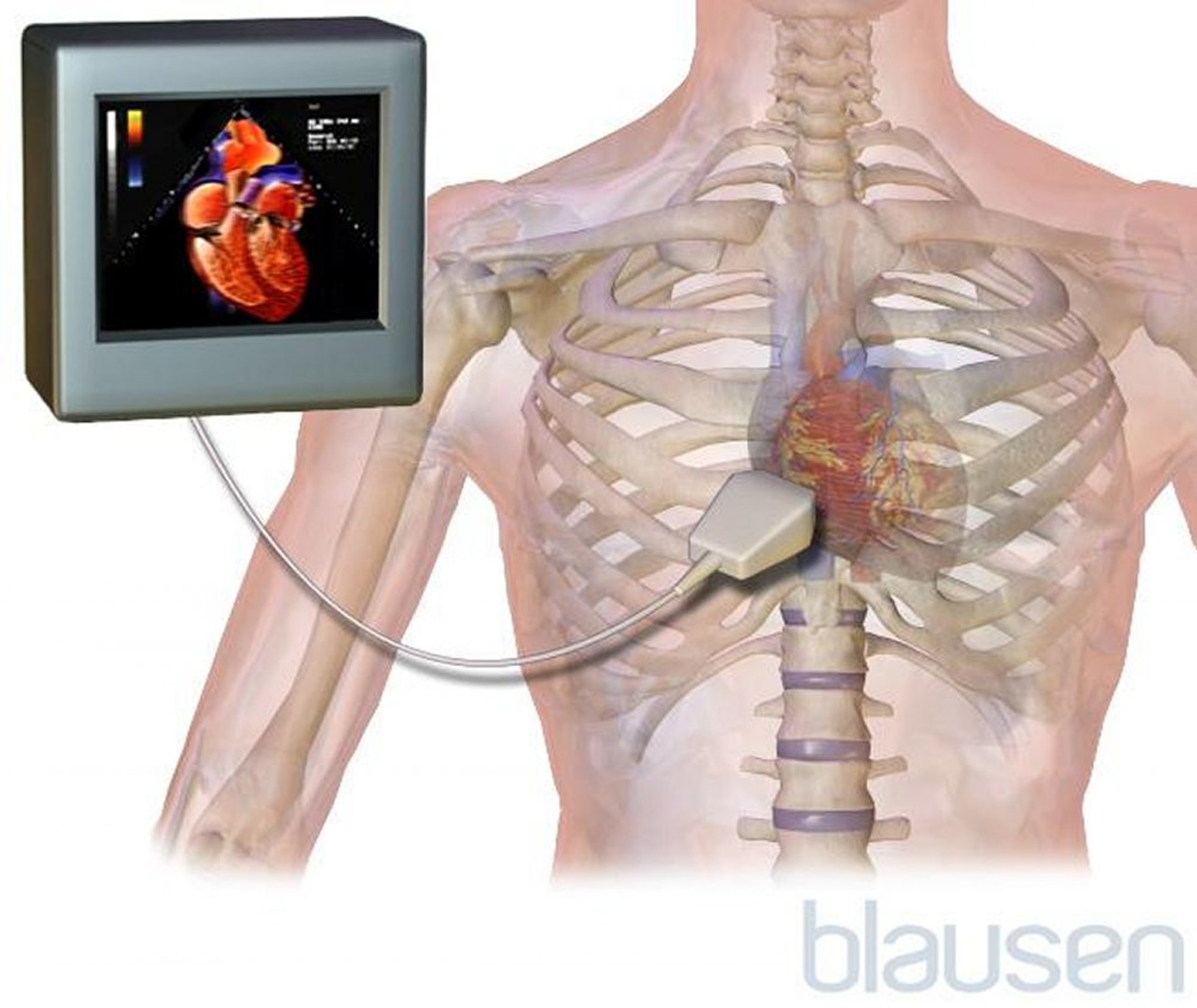 심장초음파검사(삽화)