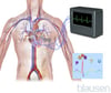Electrocardiogram