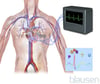 Electrocardiografía