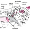 Temporal Bone