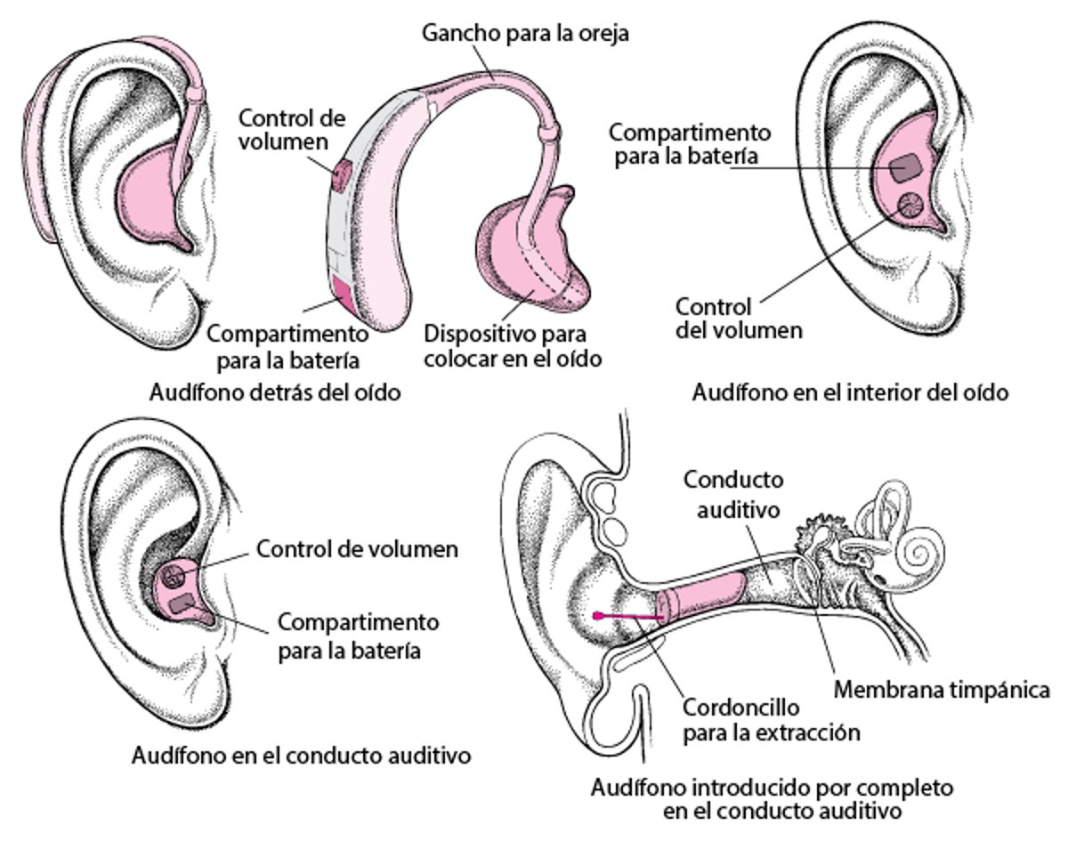 Audífonos: amplificación del sonido