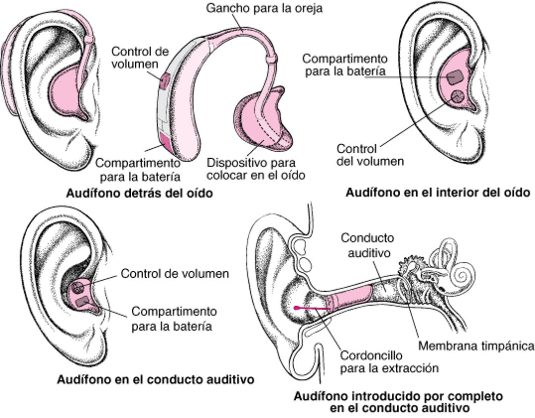 Audífonos: amplificación del sonido