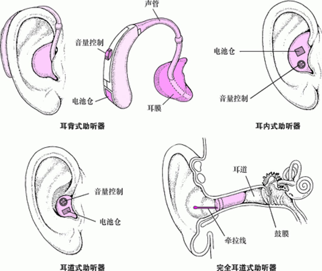 助听器：放大声音