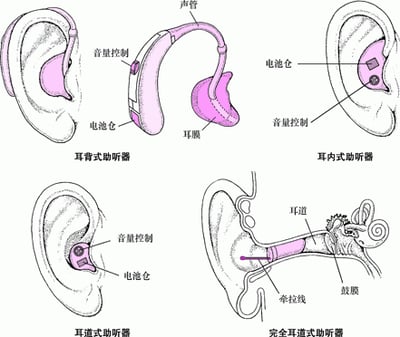 助听器：放大声音