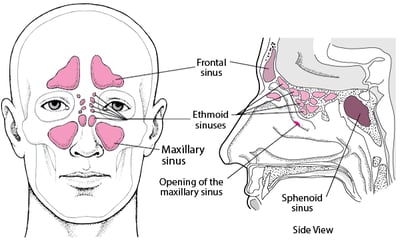Locating the Sinuses