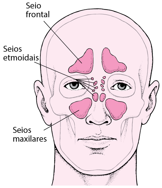 Sinusite - Distúrbios do ouvido, nariz e garganta - Manual MSD Versão ...