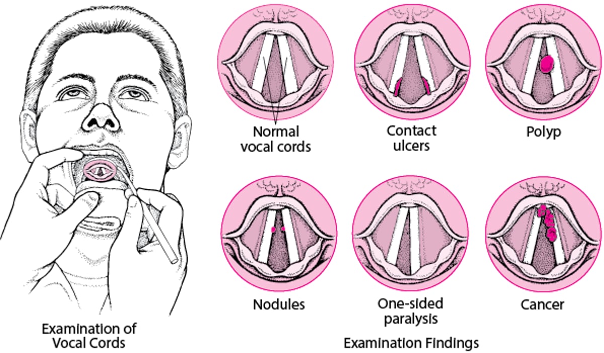 Vocal Cord Problems