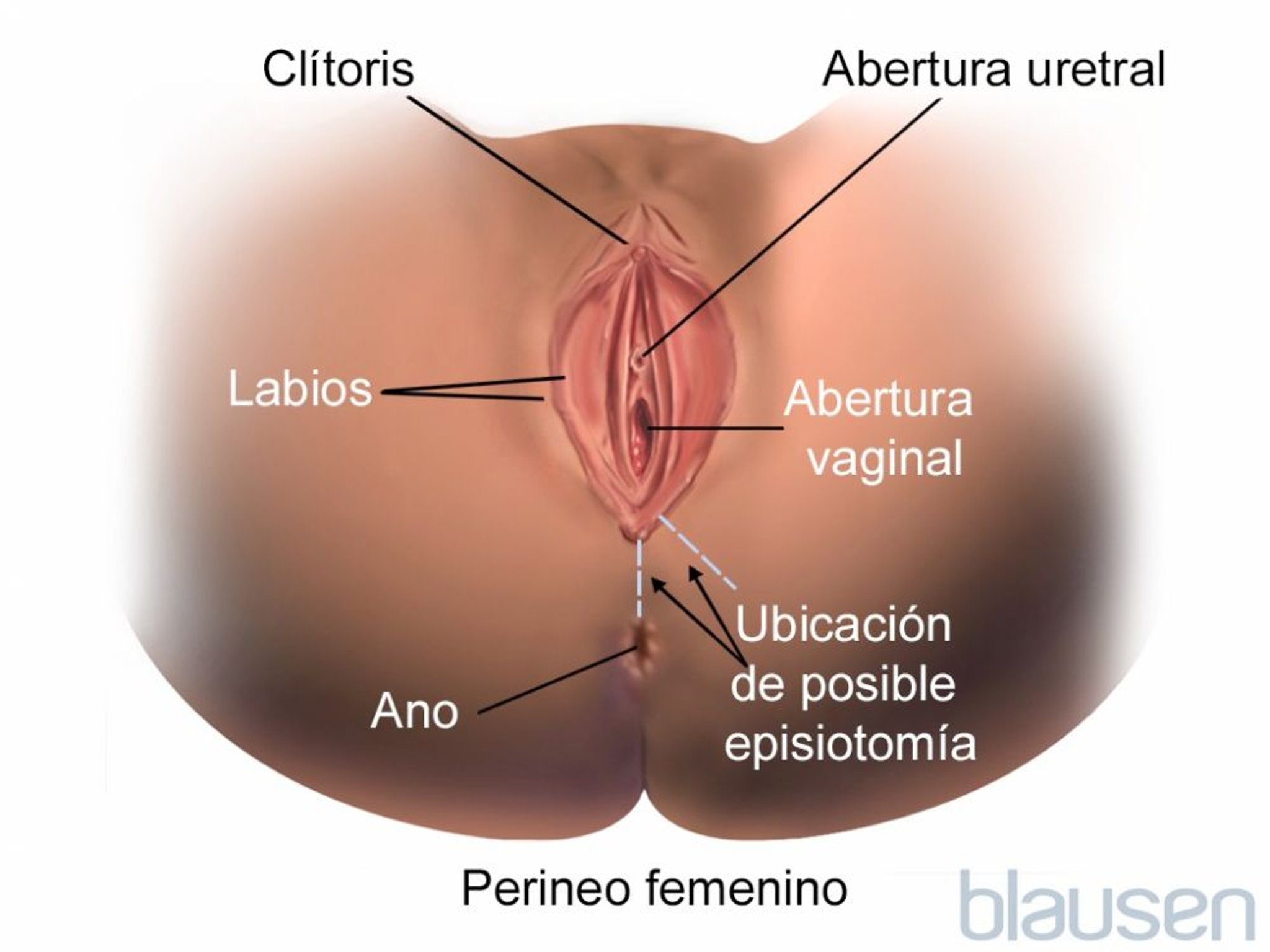 Episiotomía