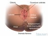 Épisiotomie