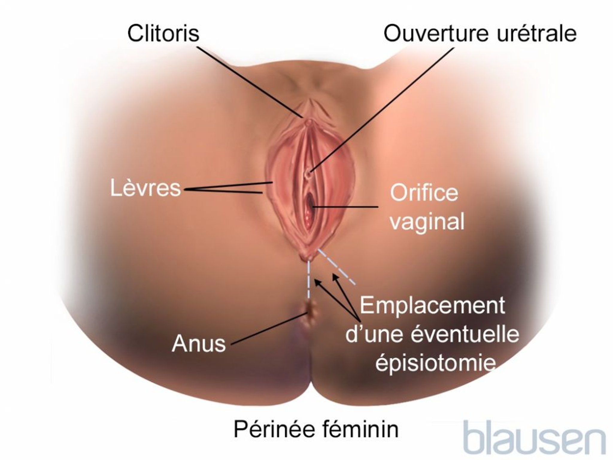Épisiotomie