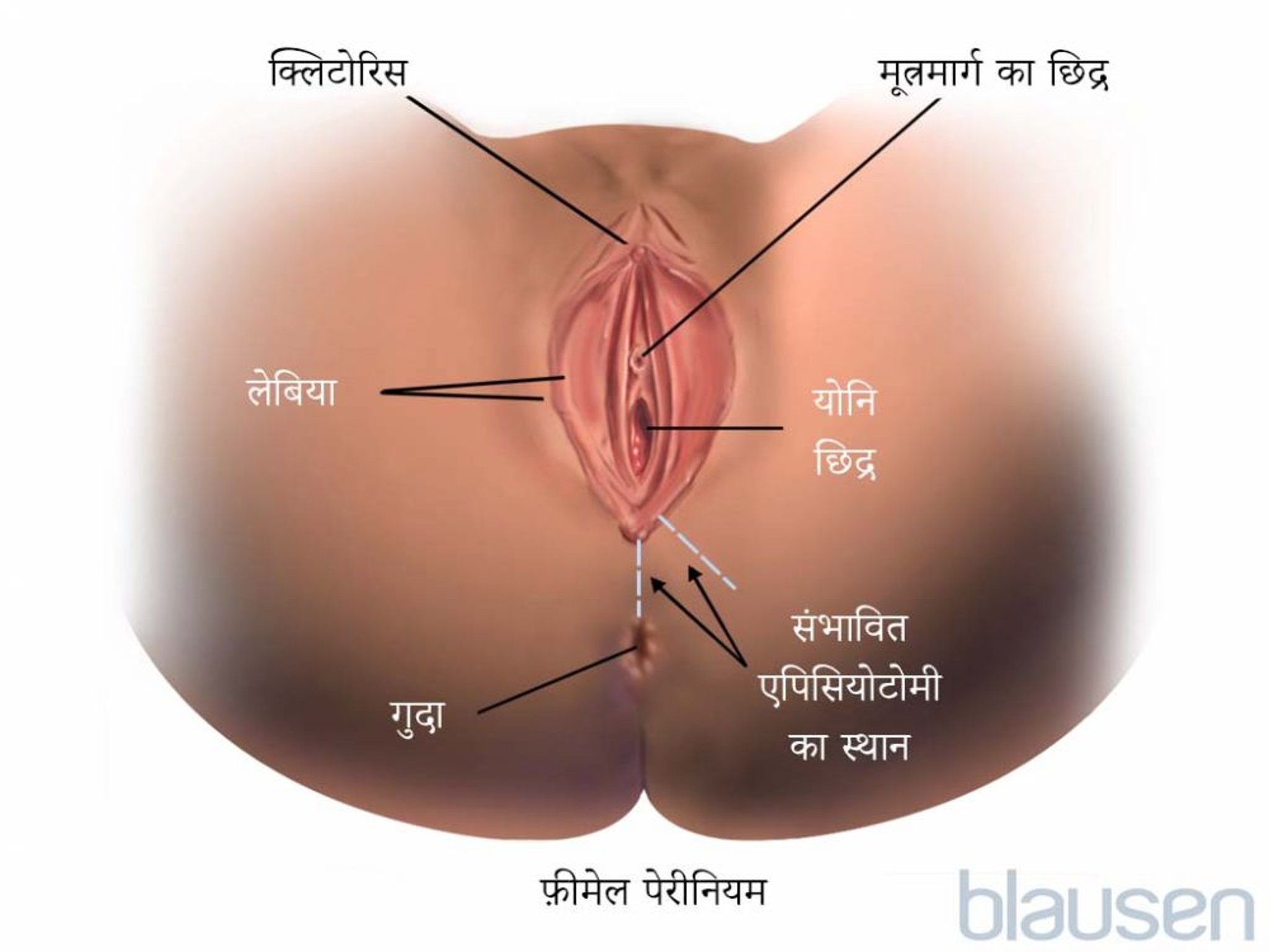 एपिसीओटॉमी