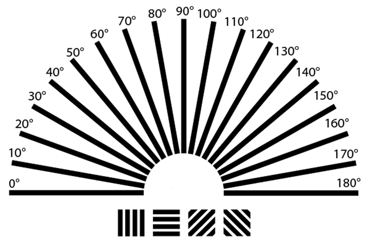 What Is Astigmatism?
