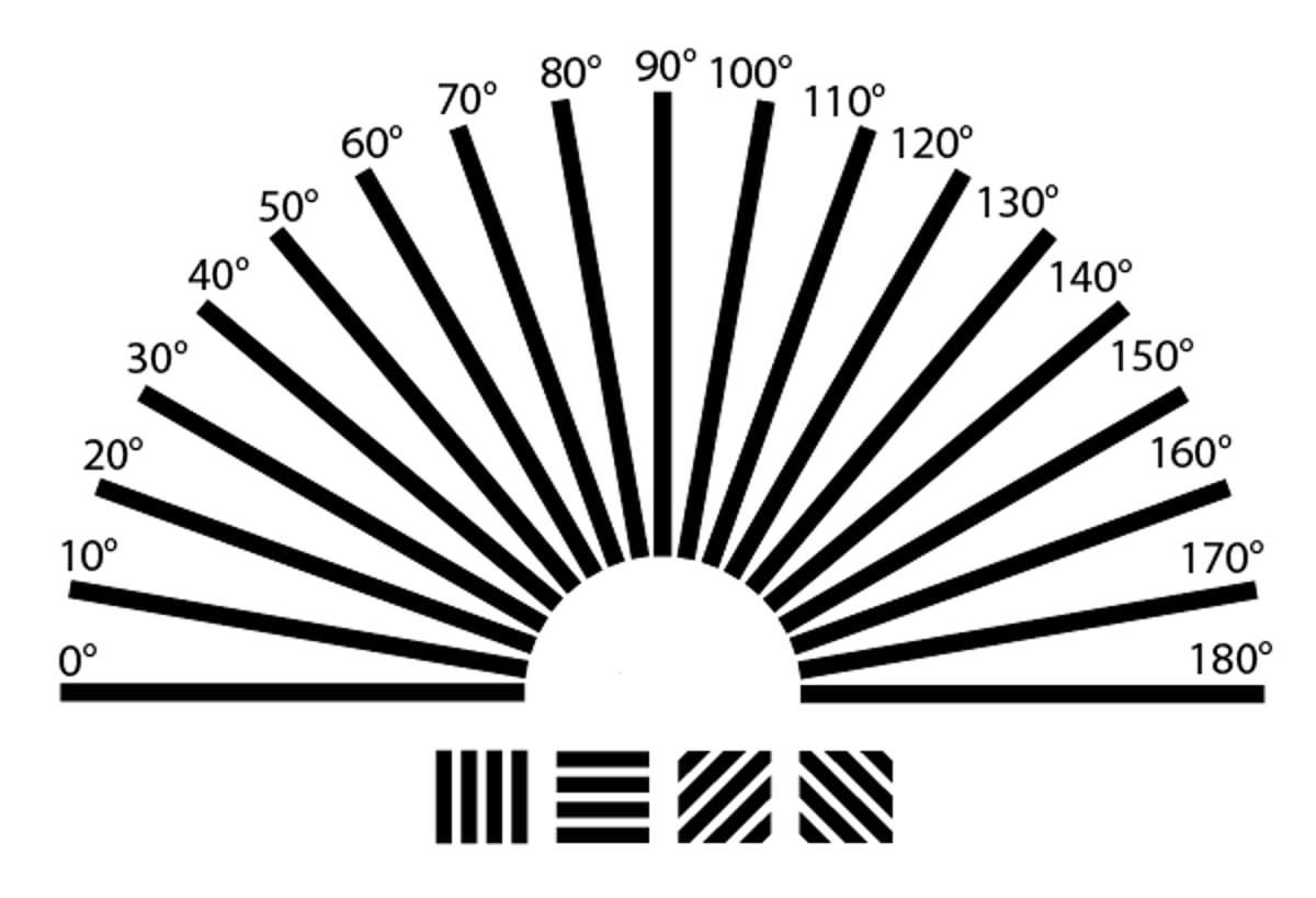 ¿Qué es el astigmatismo?
