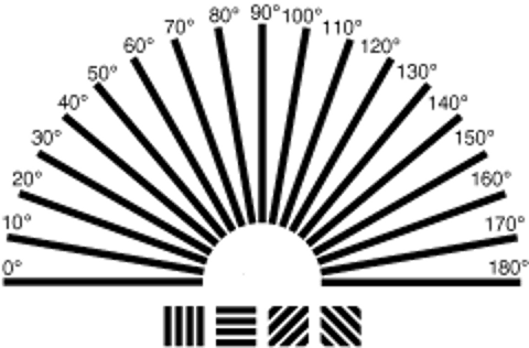Apa yang dimaksud dengan Astigmatisme?