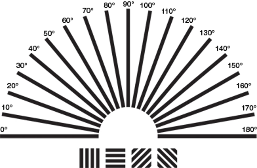 Что такое астигматизм?