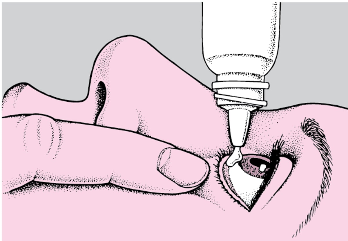 Using Eye Drops and Eye Ointments