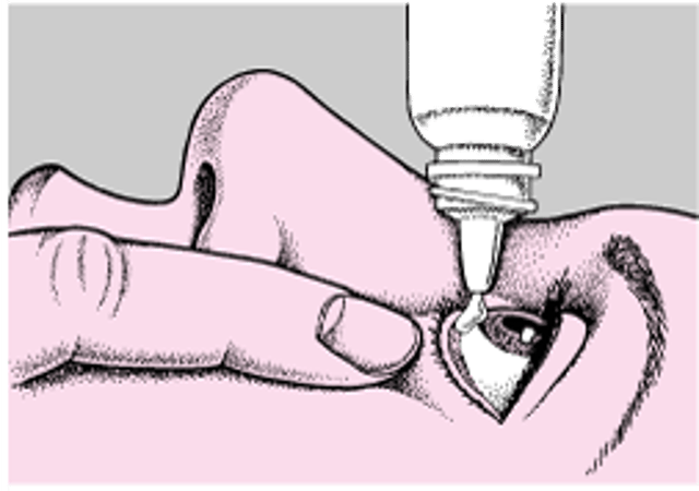 استخدام القطرات والمراهم العينية