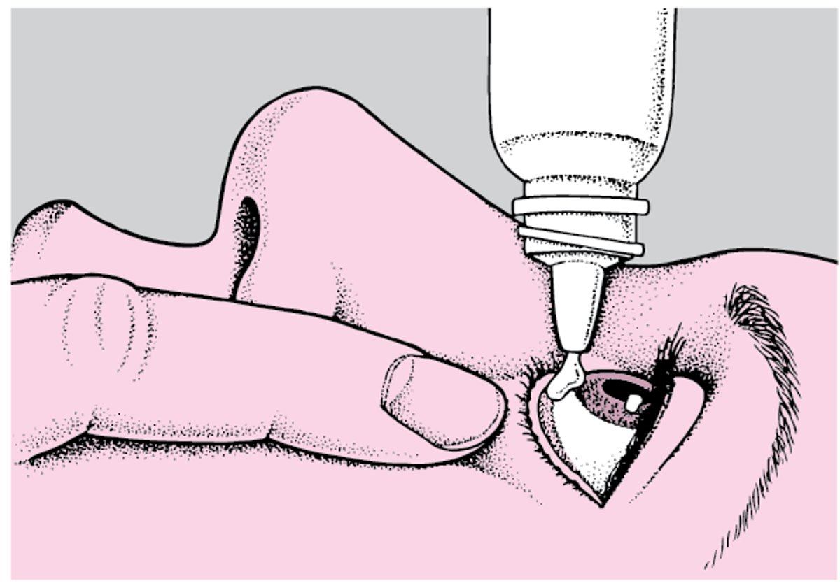 点眼薬および眼軟膏の使い方