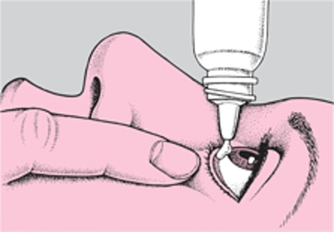 Применение глазных капель и глазных мазей