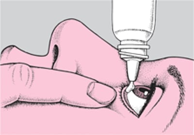 如何点眼药水和眼膏