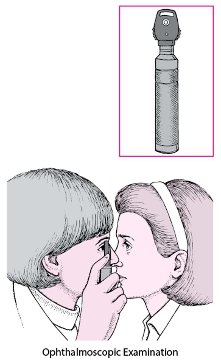 What Is an Ophthalmoscope?