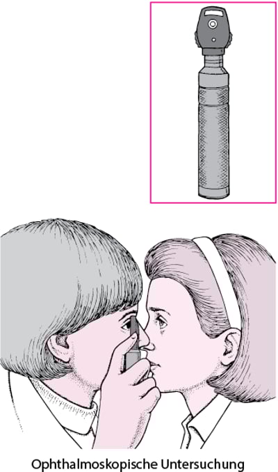 Was ist ein Ophthalmoskop?