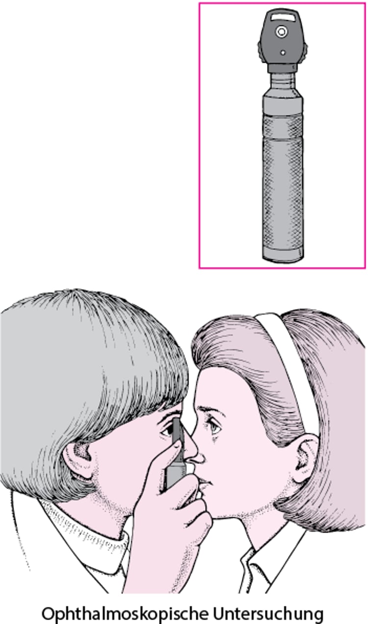 Was ist ein Ophthalmoskop?