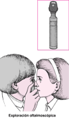 ¿Qué es un oftalmoscopio?