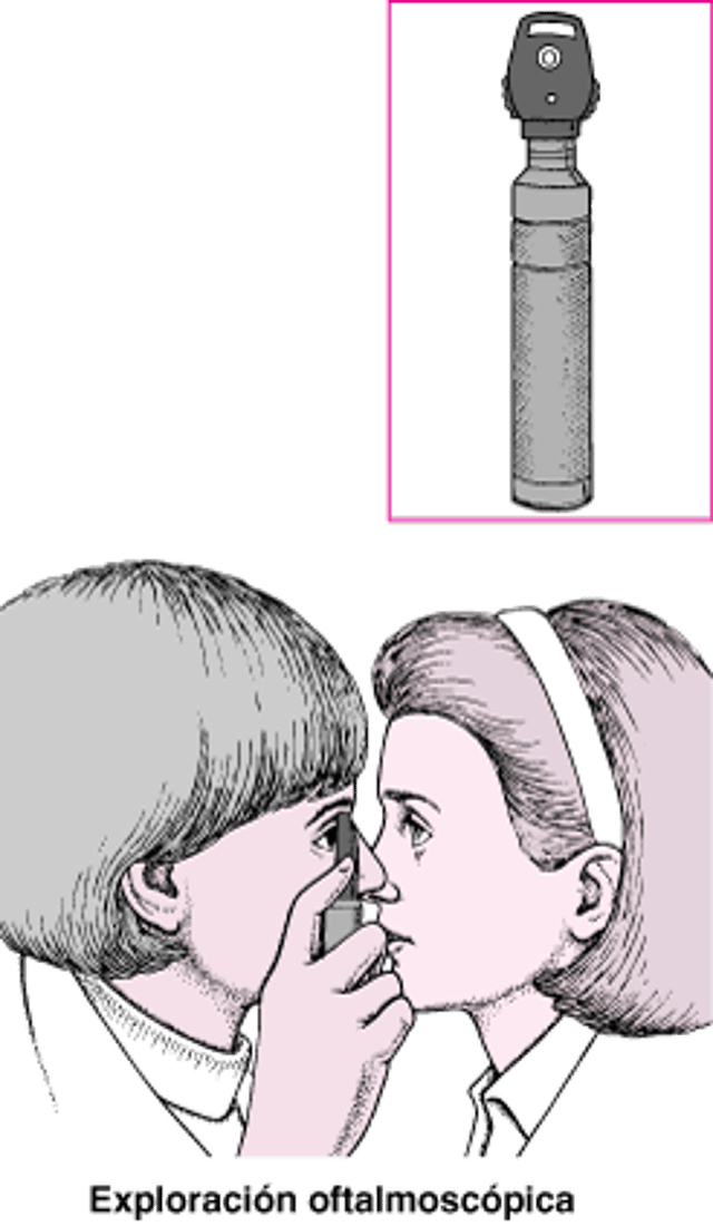 ¿Qué es un oftalmoscopio?