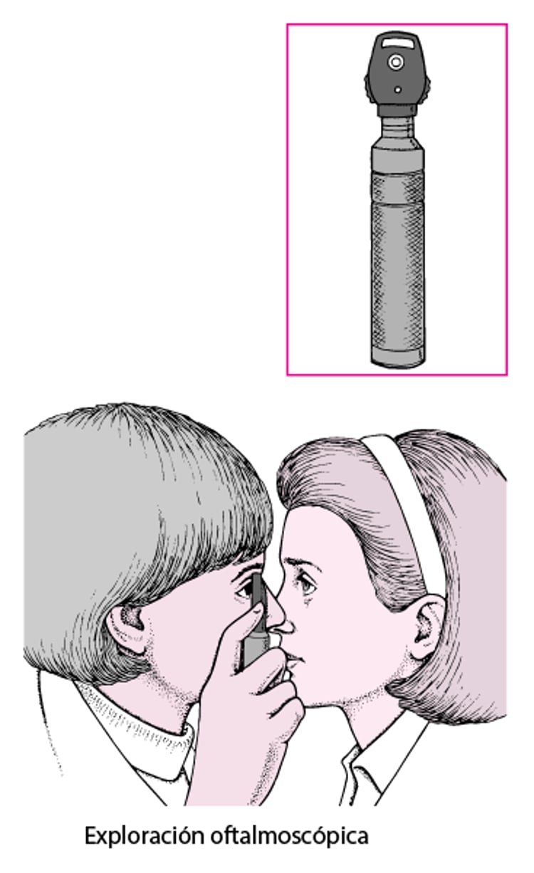 ¿Qué es un oftalmoscopio?