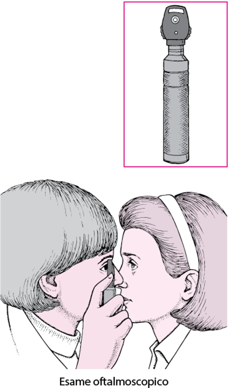 Cos’è un oftalmoscopio?