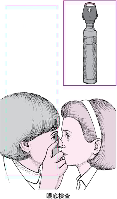 検眼鏡とは