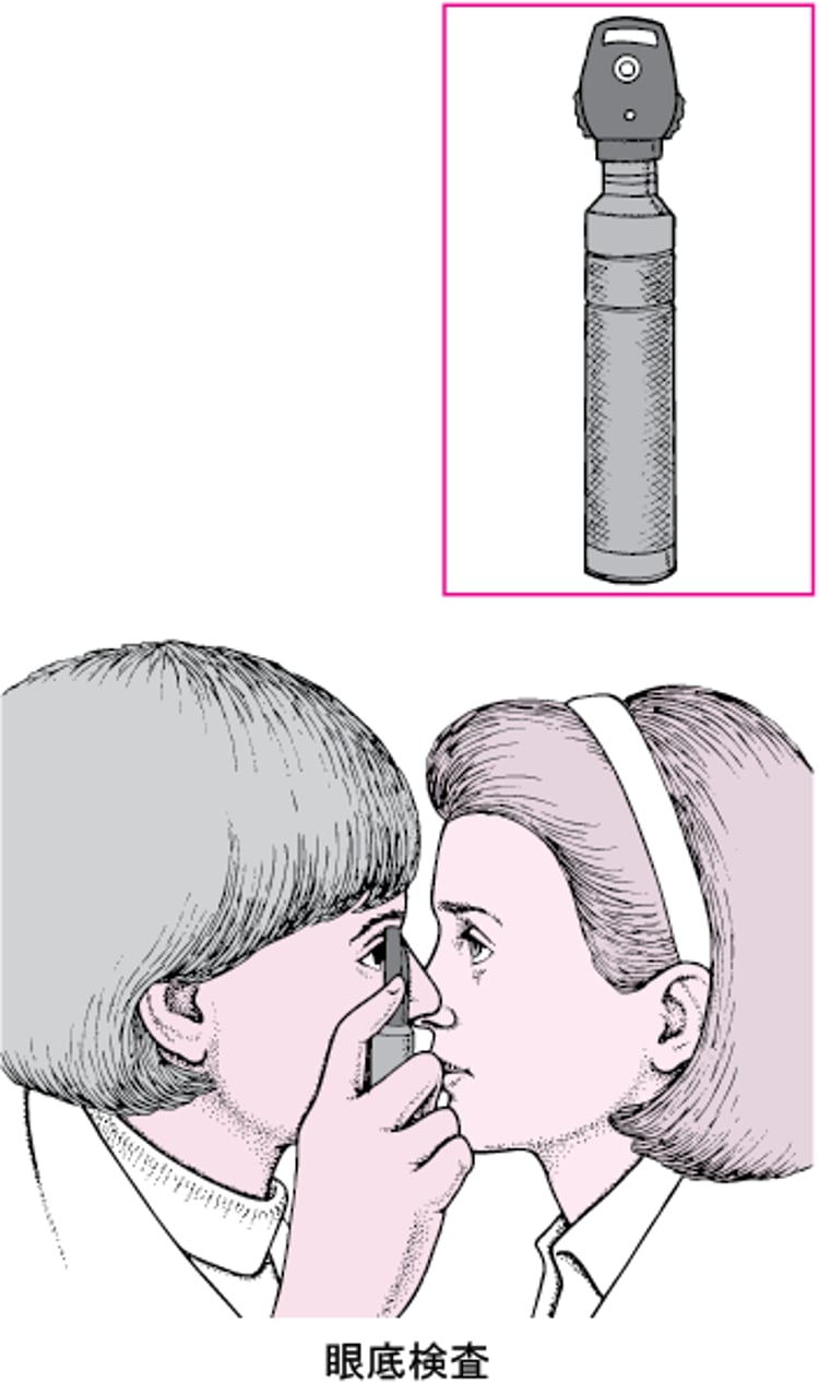検眼鏡とは