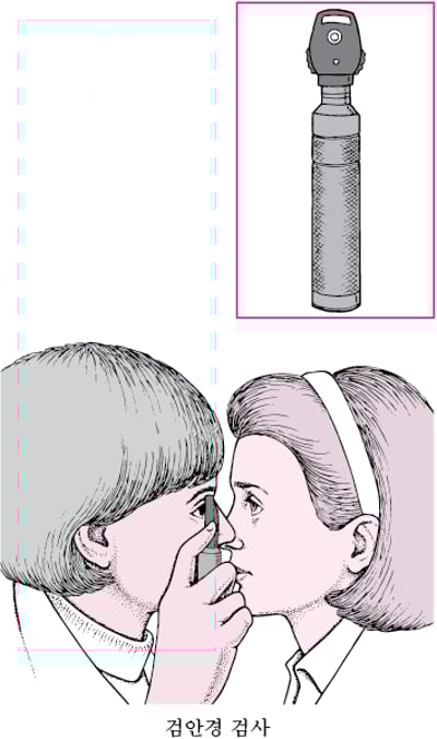 검안경이란?