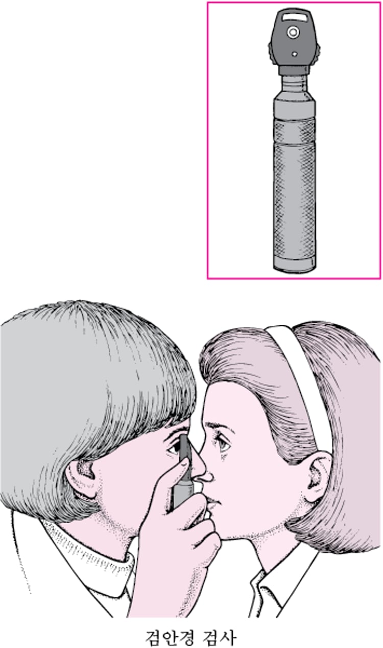 검안경이란?