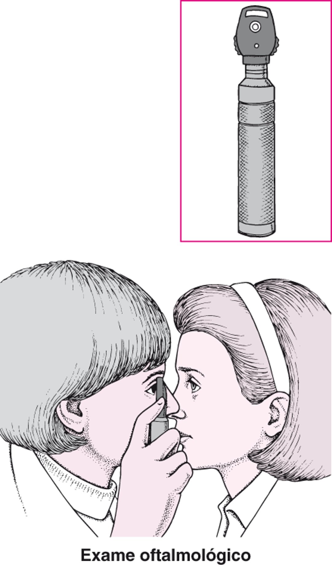 O que é o oftalmoscópio?