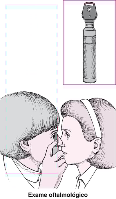 O que é o oftalmoscópio?
