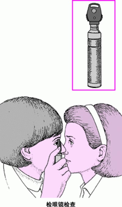 何为检眼镜?