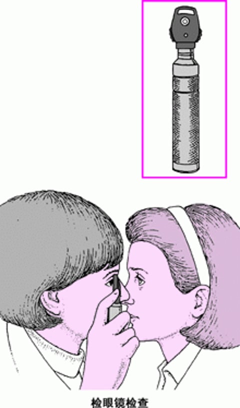何为检眼镜?