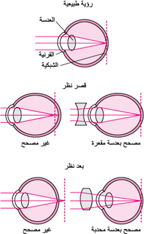 فهم الانكسار