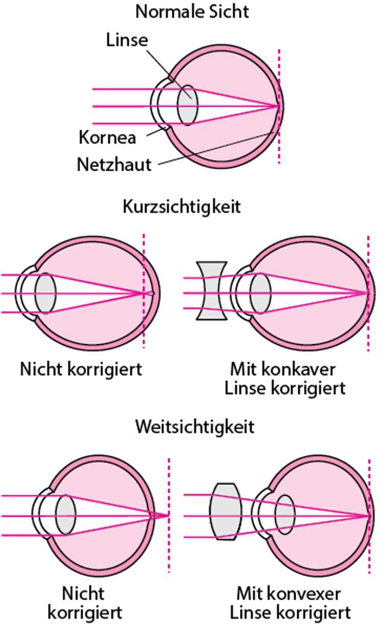 Was ist Lichtbrechung?