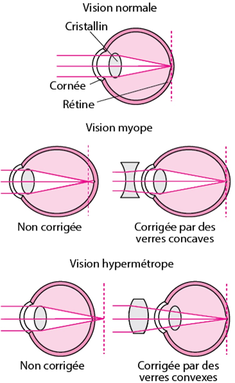 Comprendre la réfraction