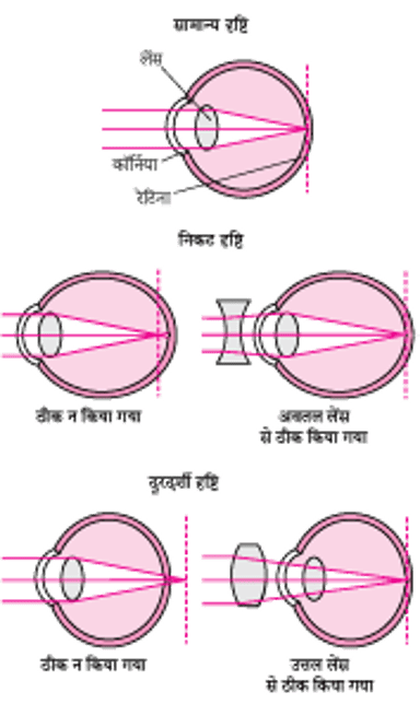 अपवर्तन को समझना