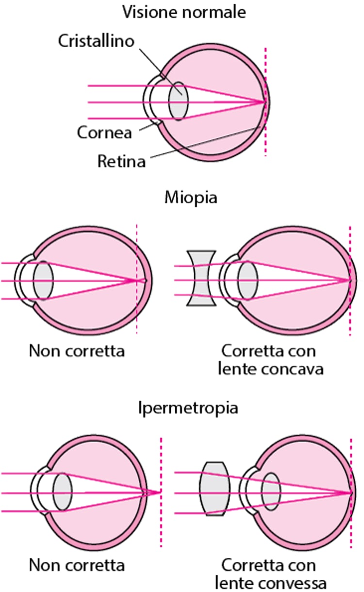 Informazioni sulla rifrazione