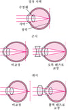 굴절에 대한 이해