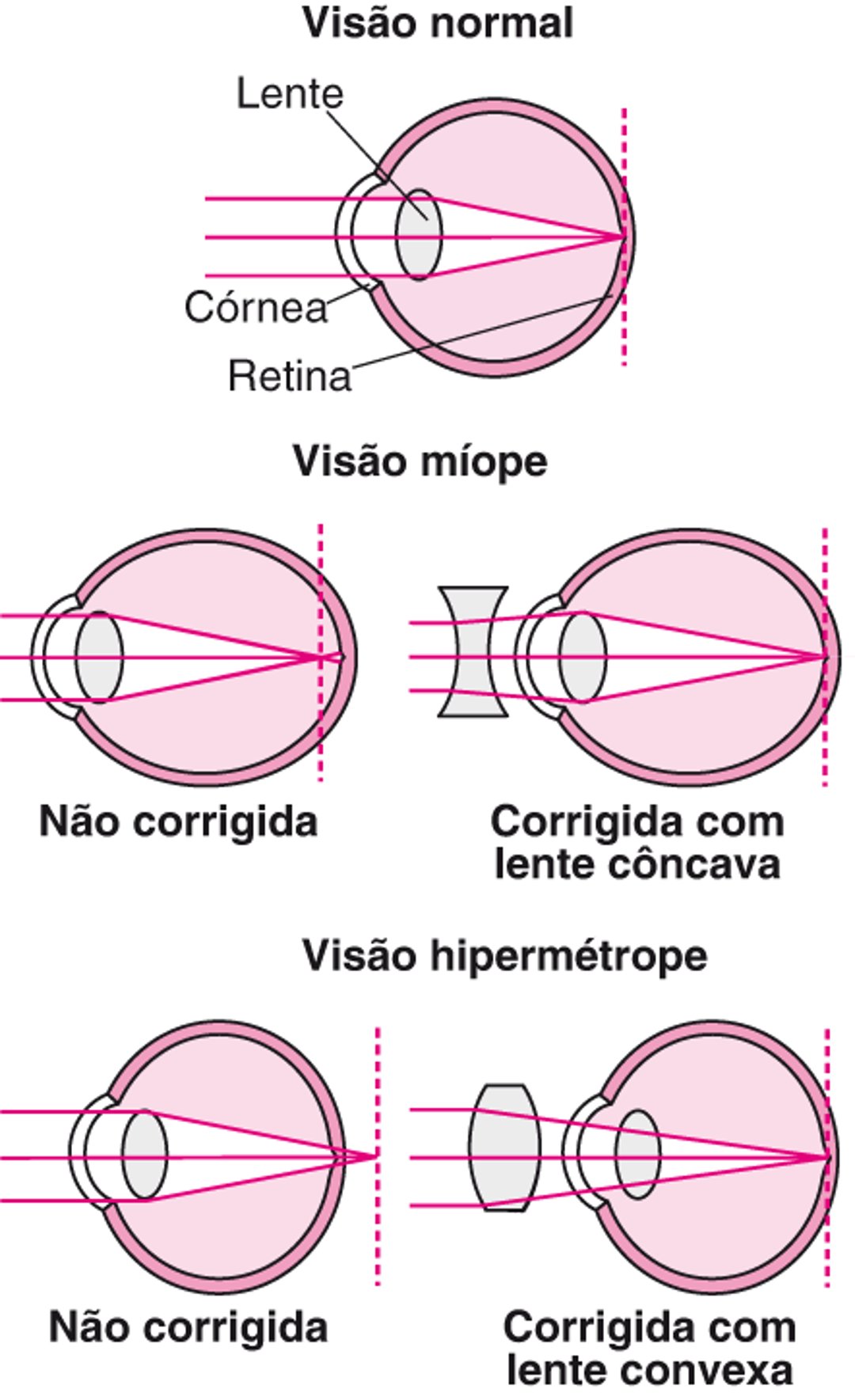 Entendendo a refração